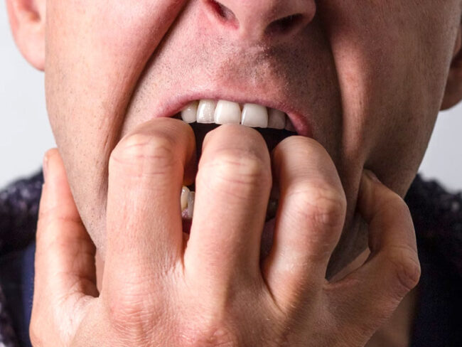 Tratamiento para dejar de morderse las uñas en Castellón